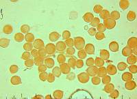 Chrysomphalina strombodes image