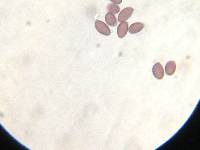 Protostropharia semiglobata image