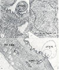 Coelomomyces psorophorae image