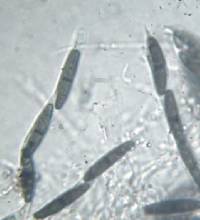Seynesia erumpens image