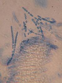 Hypocrea pulvinata image