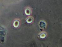 Multifurca ochricompacta image