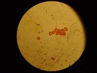 Amanita sect. Vaginatae image