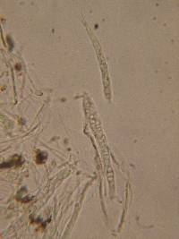 Patellariopsis clavispora image