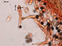 Lacrymaria hypertropicalis image
