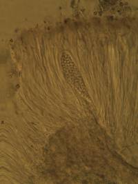 Acarospora placodiiformis image