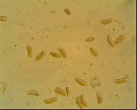 Dacrymyces variisporus image