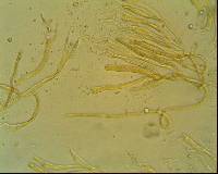 Dacrymyces variisporus image