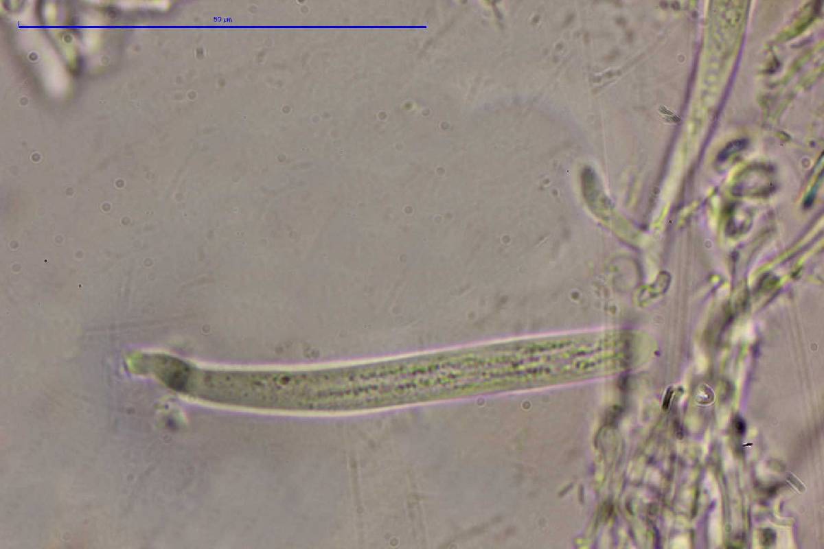 Lachnum abnormis image