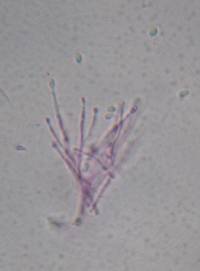 Stilbella fimetaria image