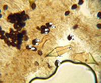 Panaeolus bisporus image