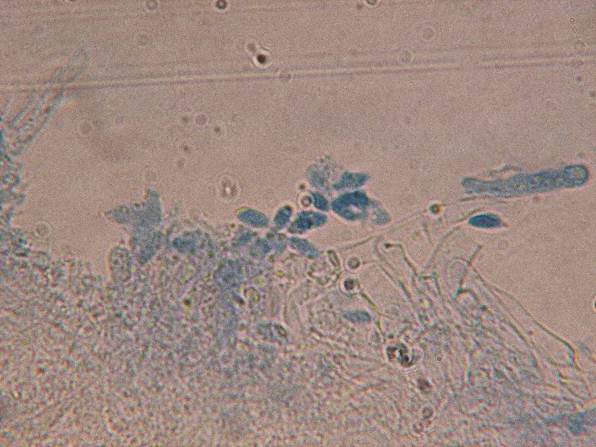 Flammulaster fusisporus image