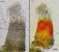Micarea neostipitata image