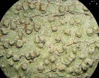 Pertusaria texana image