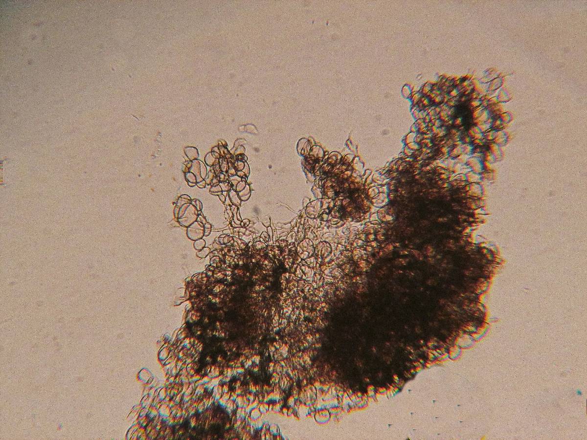 Echinoderma pseudoasperulum image