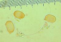 Hygrocybe olivaceonigra image