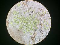 Mycocalicium subtile image