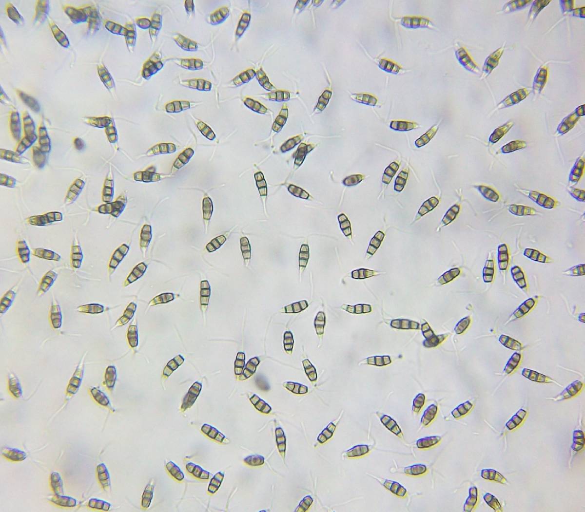 Pestalotiopsis image
