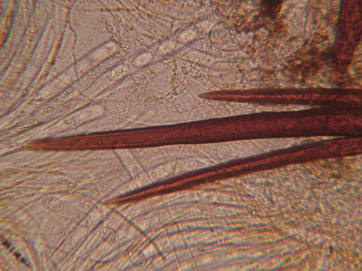 Scutellinia umbrorum image