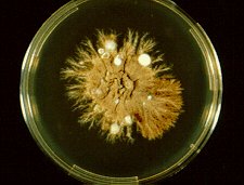 Epidermophyton image