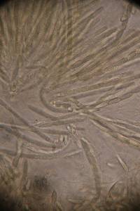 Hypomyces hyalinus image