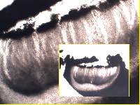 Pertusaria multipuncta image