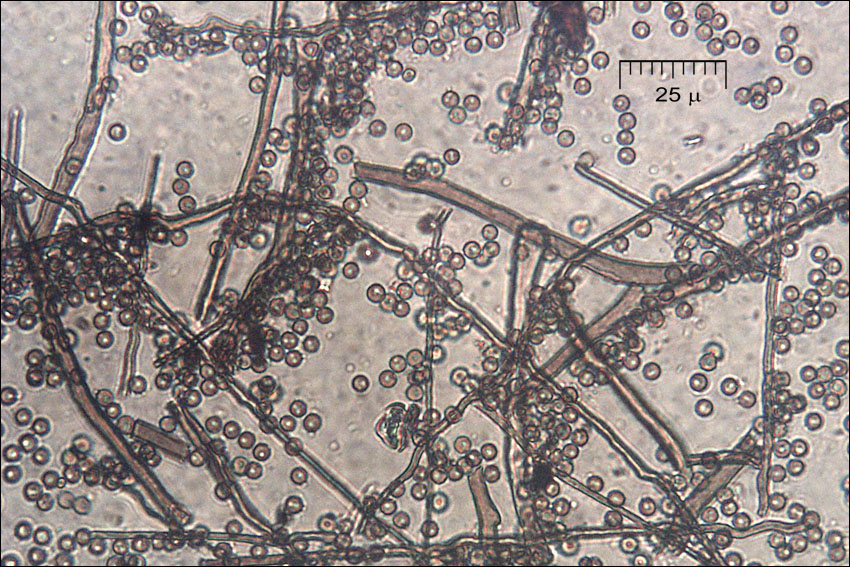 Lycoperdon lividum image