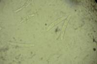 Calonectria pyrochroa image