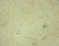 Calosphaeria cyclospora image