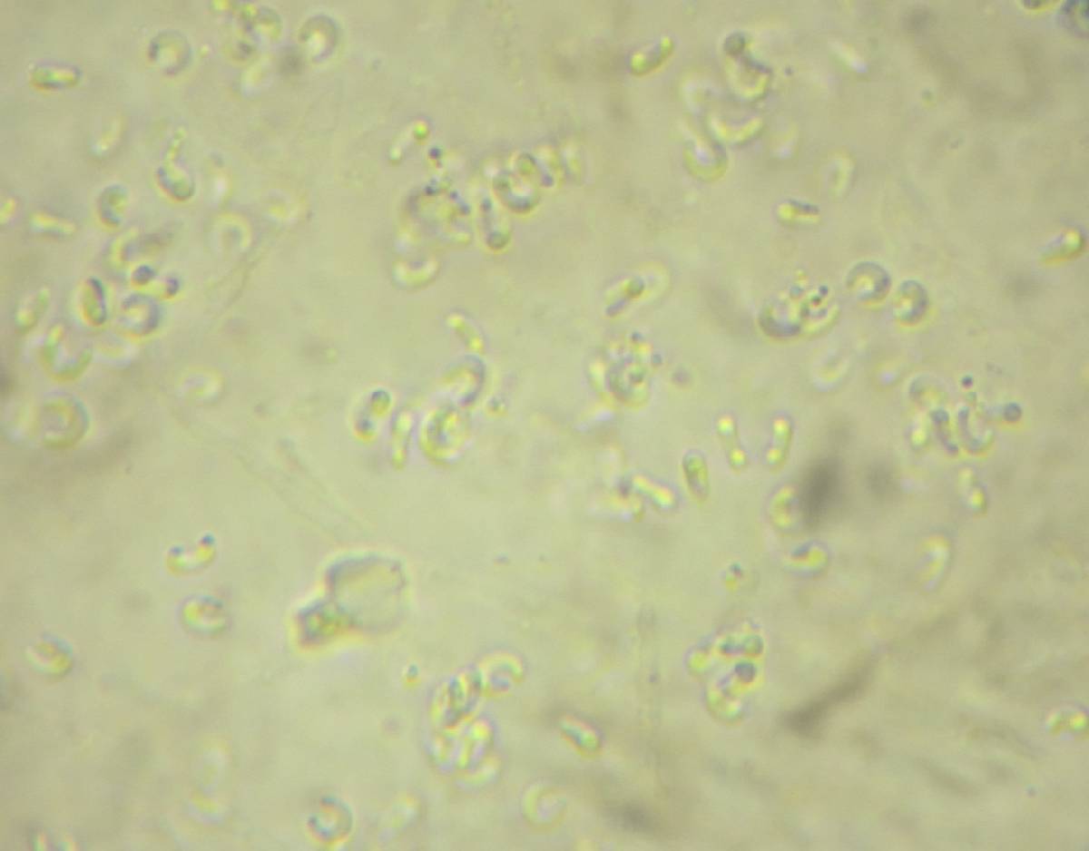 Calosphaeria cyclospora image