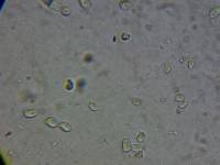 Mucronella bresadolae image