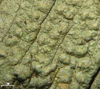 Pertusaria epixantha image