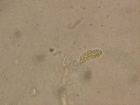 Dacrymyces variisporus image