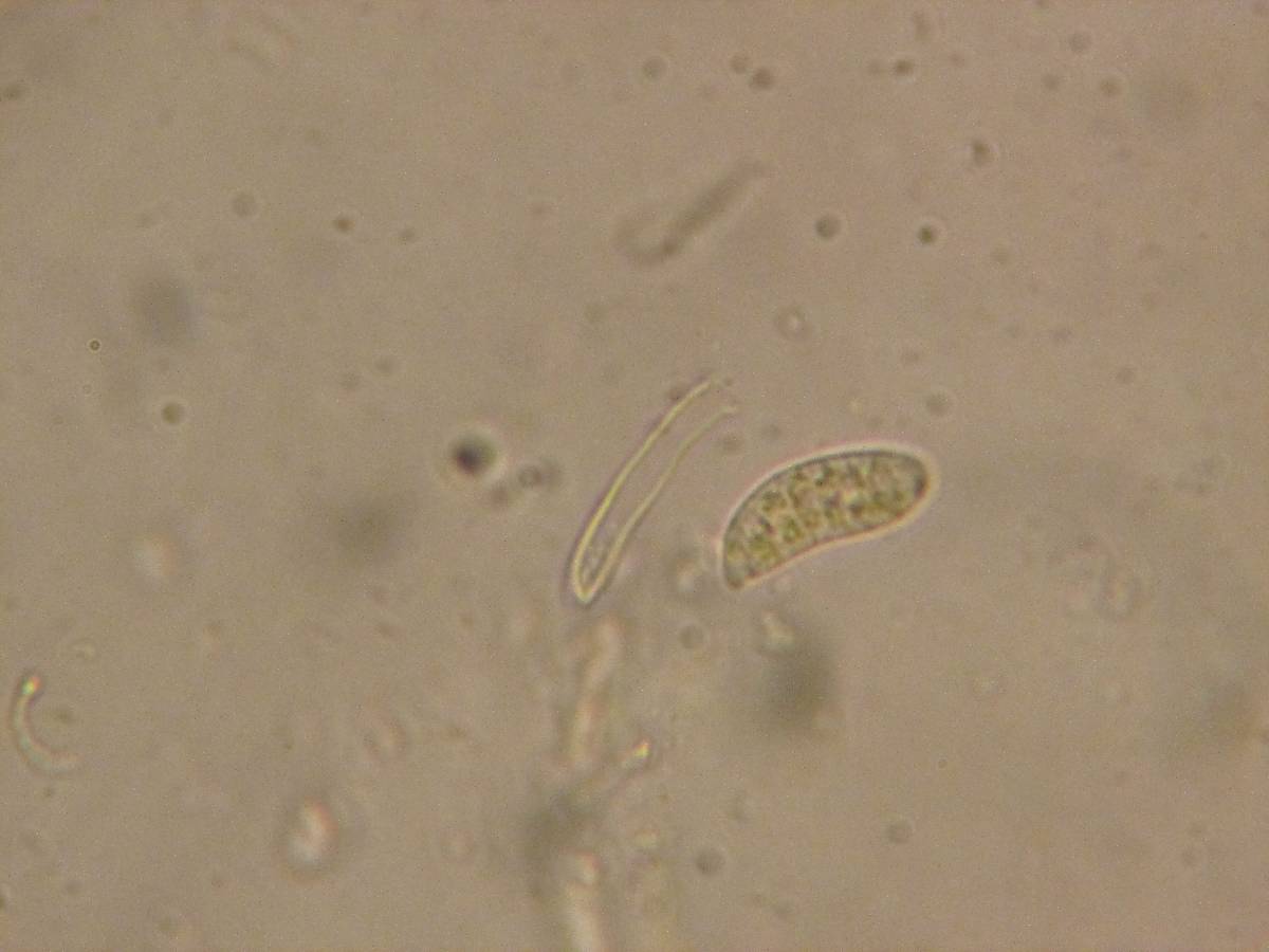 Dacrymyces variisporus image