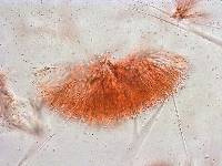 Ascocoryne trichophora image