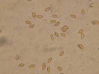 Cortinarius heterosporus image