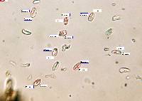 Peniophorella pubera image