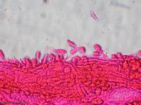 Akanthomyces aranearum image