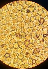 Sphaerosporium lignatile image