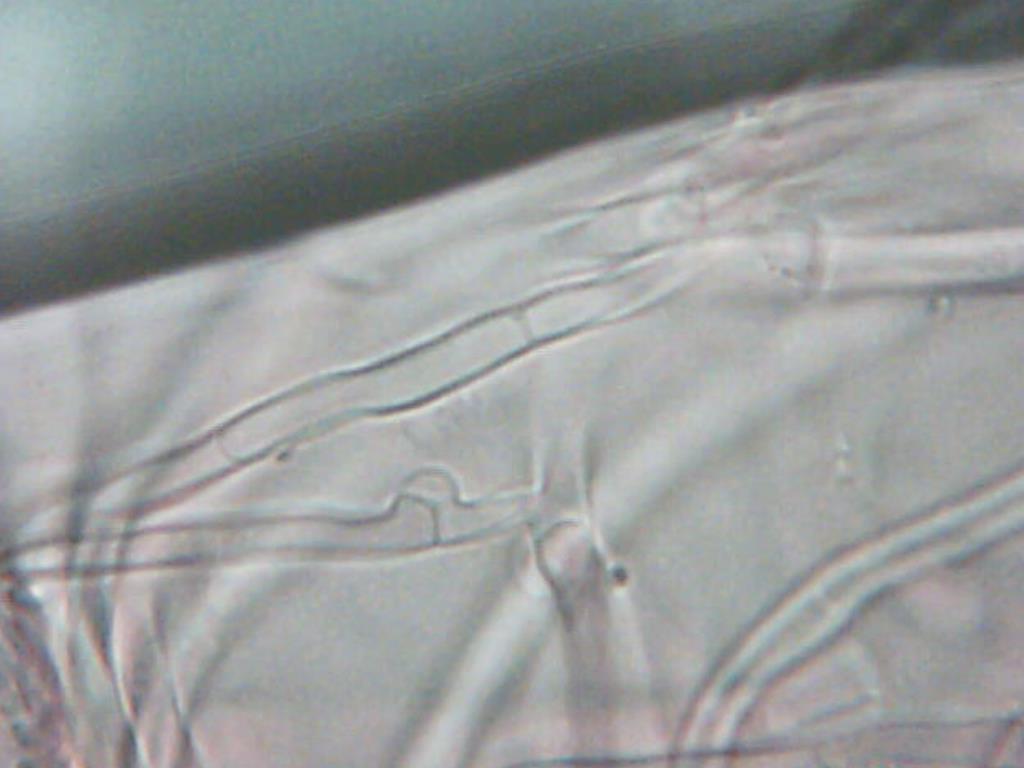 Podoscypha thozetii image