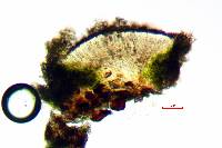 Lecanora substrobilina image