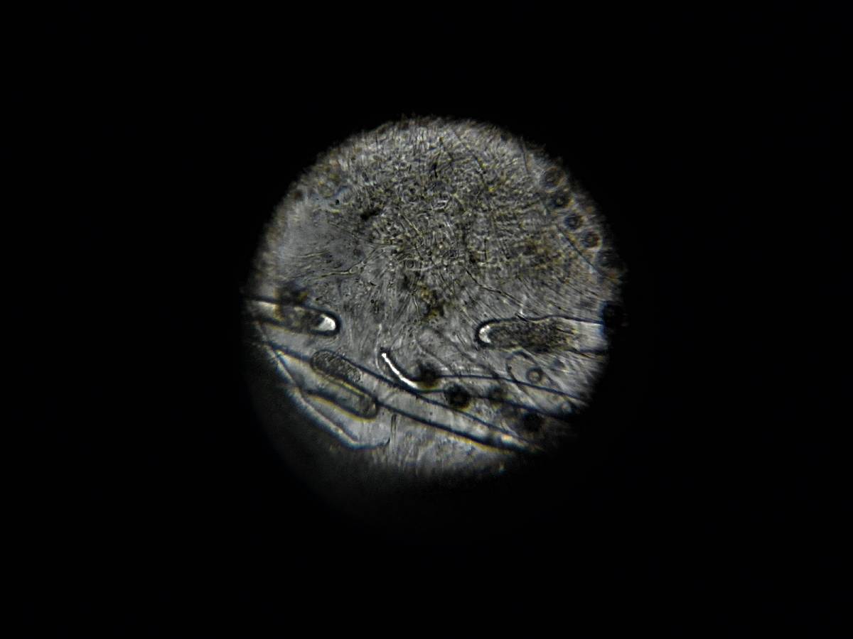 Ruhlandiella image