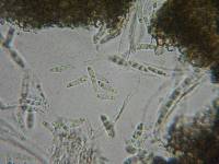 Mollisia ventosa image