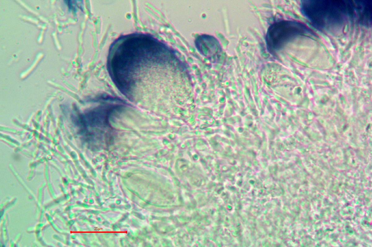 Strangospora moriformis image
