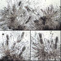 Pertusaria heterochroa image