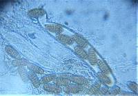 Pleospora herbarum image