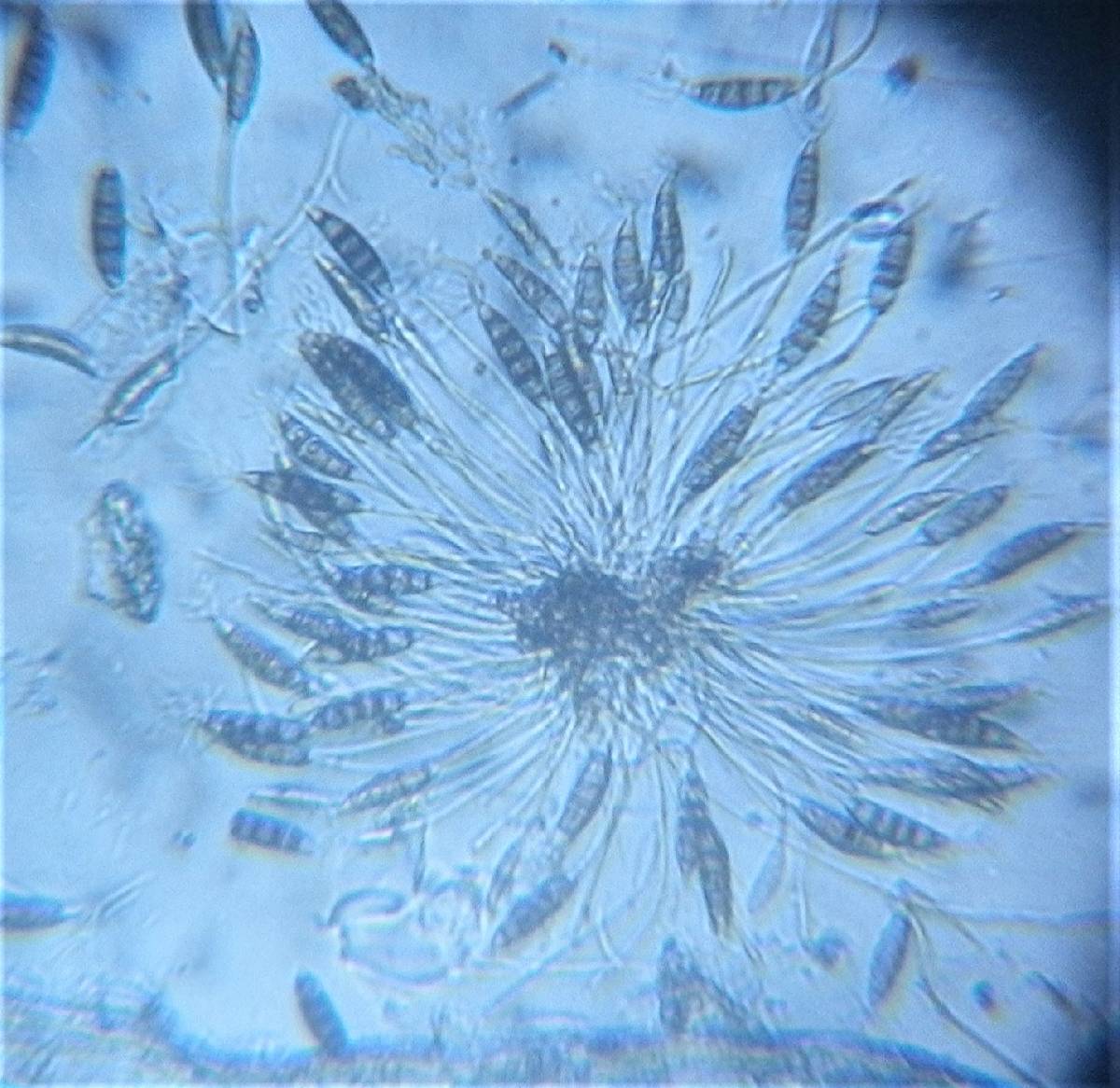 Pestalotia image