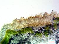 Acarospora rosulata image