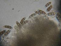 Hysterium angustatum image