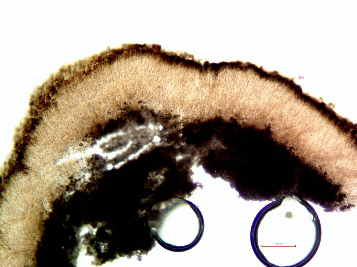 Trapeliopsis glaucopholis image